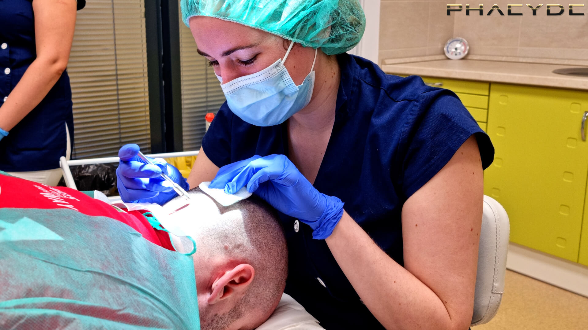 Hair Transplant Process - PHAEYDE Clinic